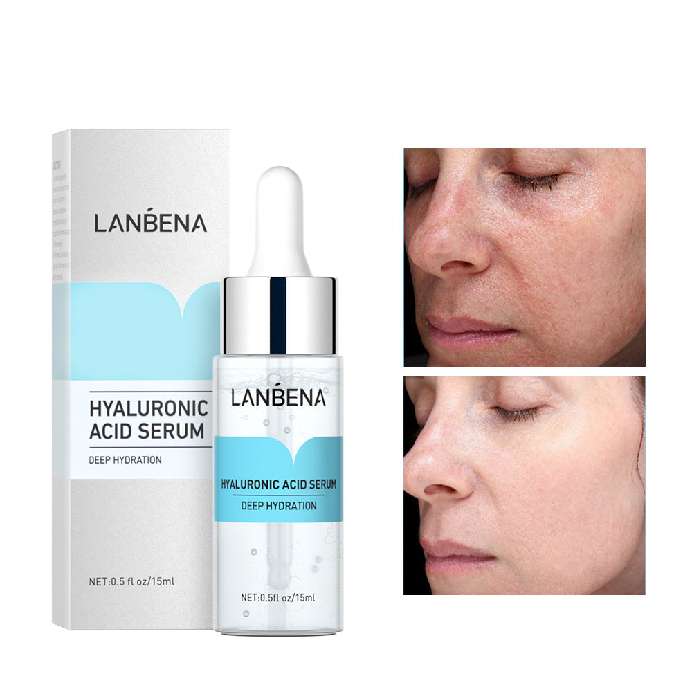 LANBENA 4 Essences 15ml (New Version) AliExpress Hot Sale (Non-BPOM)