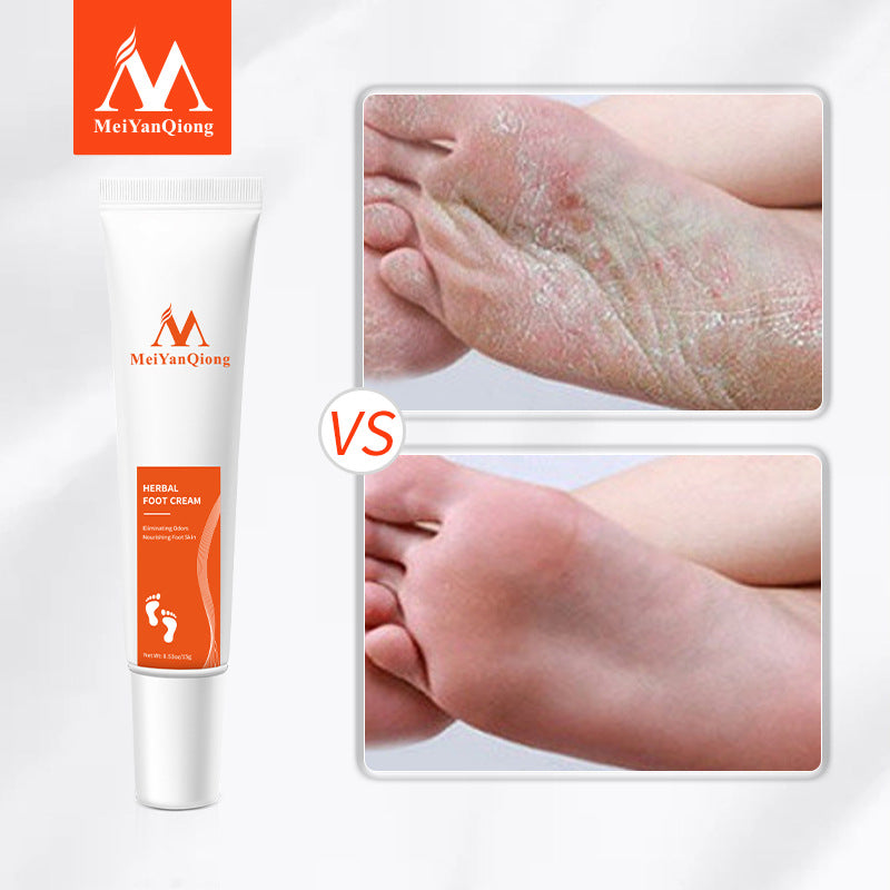 Cross-border Cosmetics Beauty Qiong Foot Cream
