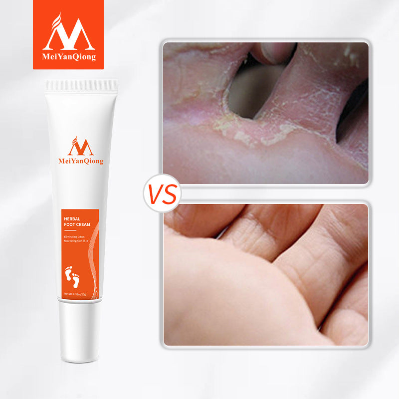 Cross-border Cosmetics Beauty Qiong Foot Cream