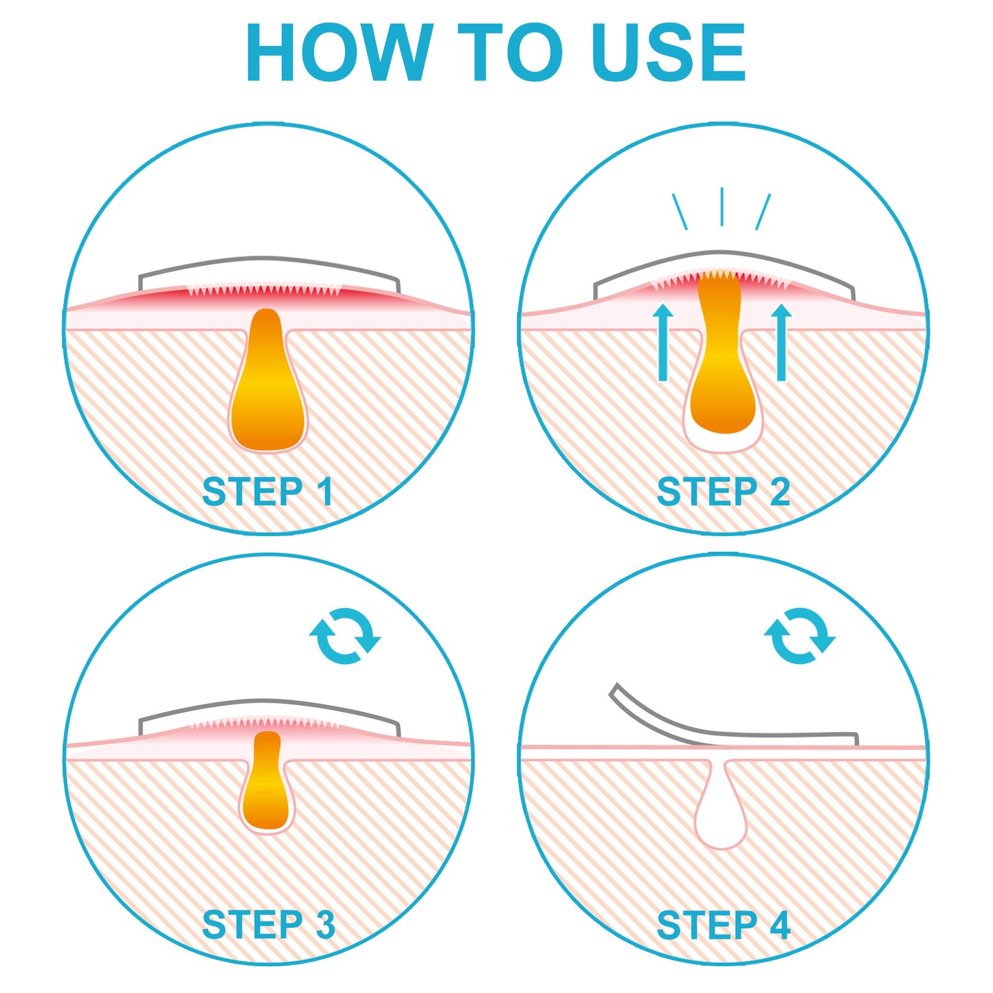 ELAIMEI New Microneedle Hydrocolloid Acne Acne Patch Portable Acne Mark Acne Invisible Patch 18 Patches