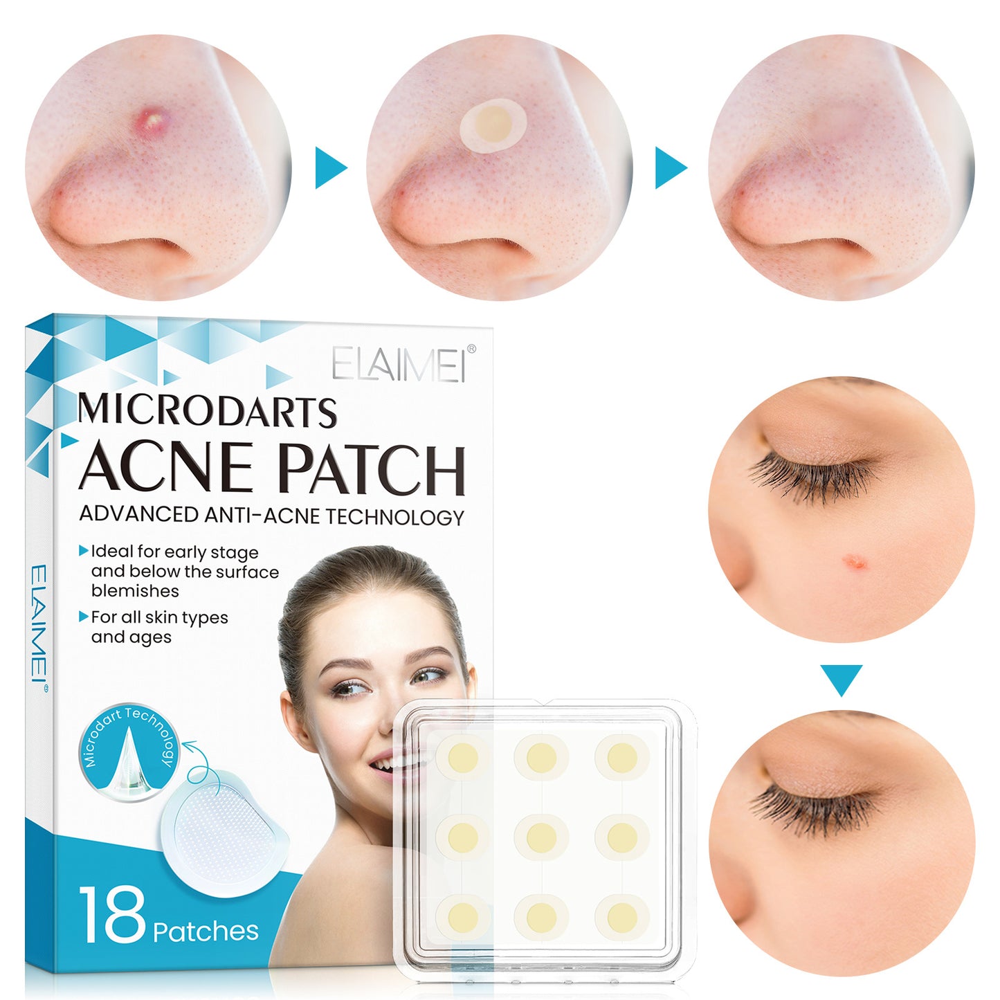 ELAIMEI New Microneedle Hydrocolloid Acne Acne Patch Portable Acne Mark Acne Invisible Patch 18 Patches